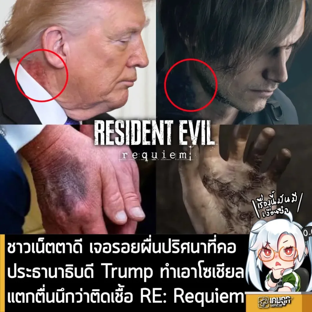 ชาวเน็ตตาดี เจอรอยผื่นที่คอ ประธานาธิบดี Trump ทำโซเชียลแตก ตื่นตระหนกนึกว่าติดเชื้อ Resident Evil