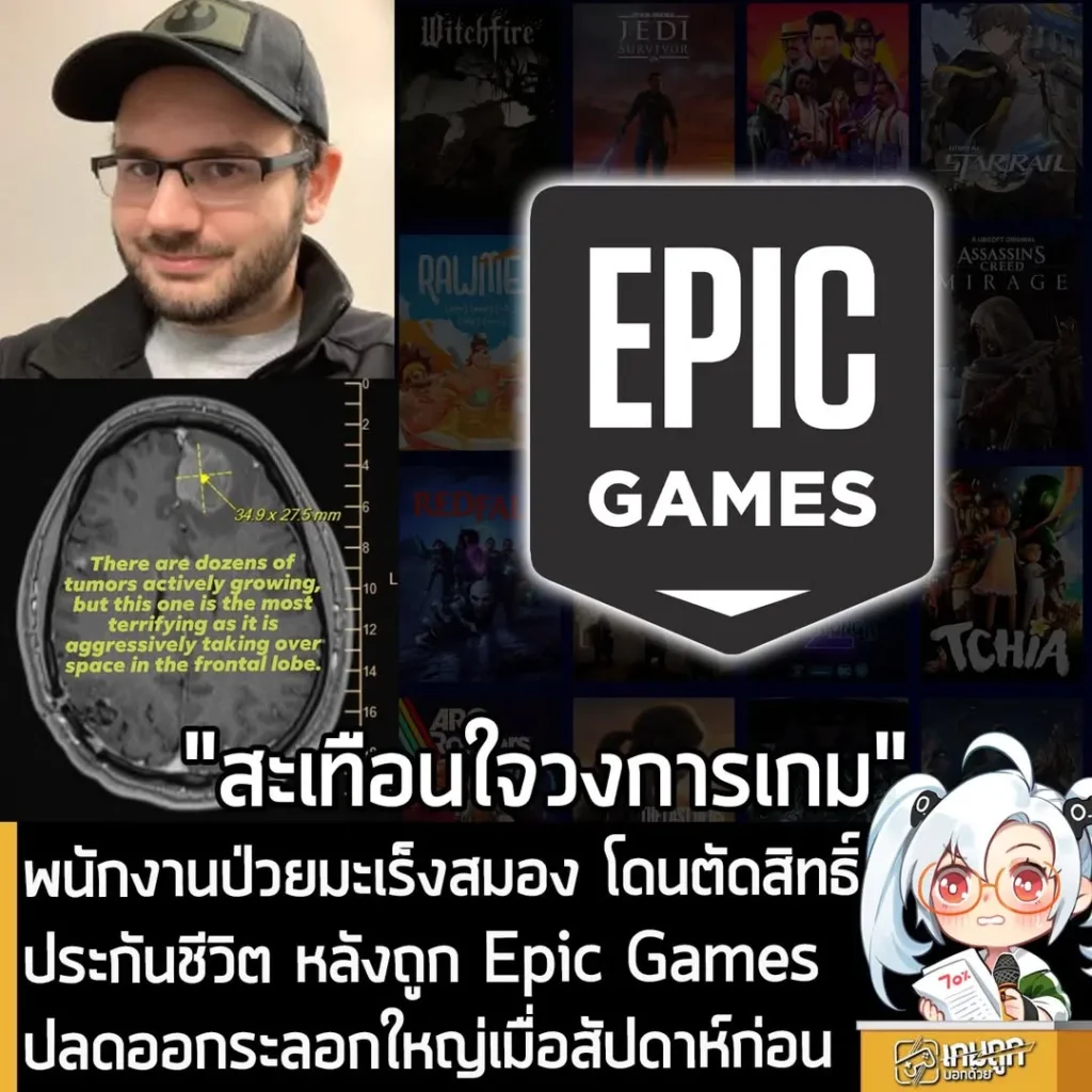 พนักงานป่วยมะเร็งสมอง โดนตัดสิทธิ์ประกันชีวิต หลังถูก Epic Games ปลดออกระลอกใหญ่เมื่อสัปดาห์ก่อน